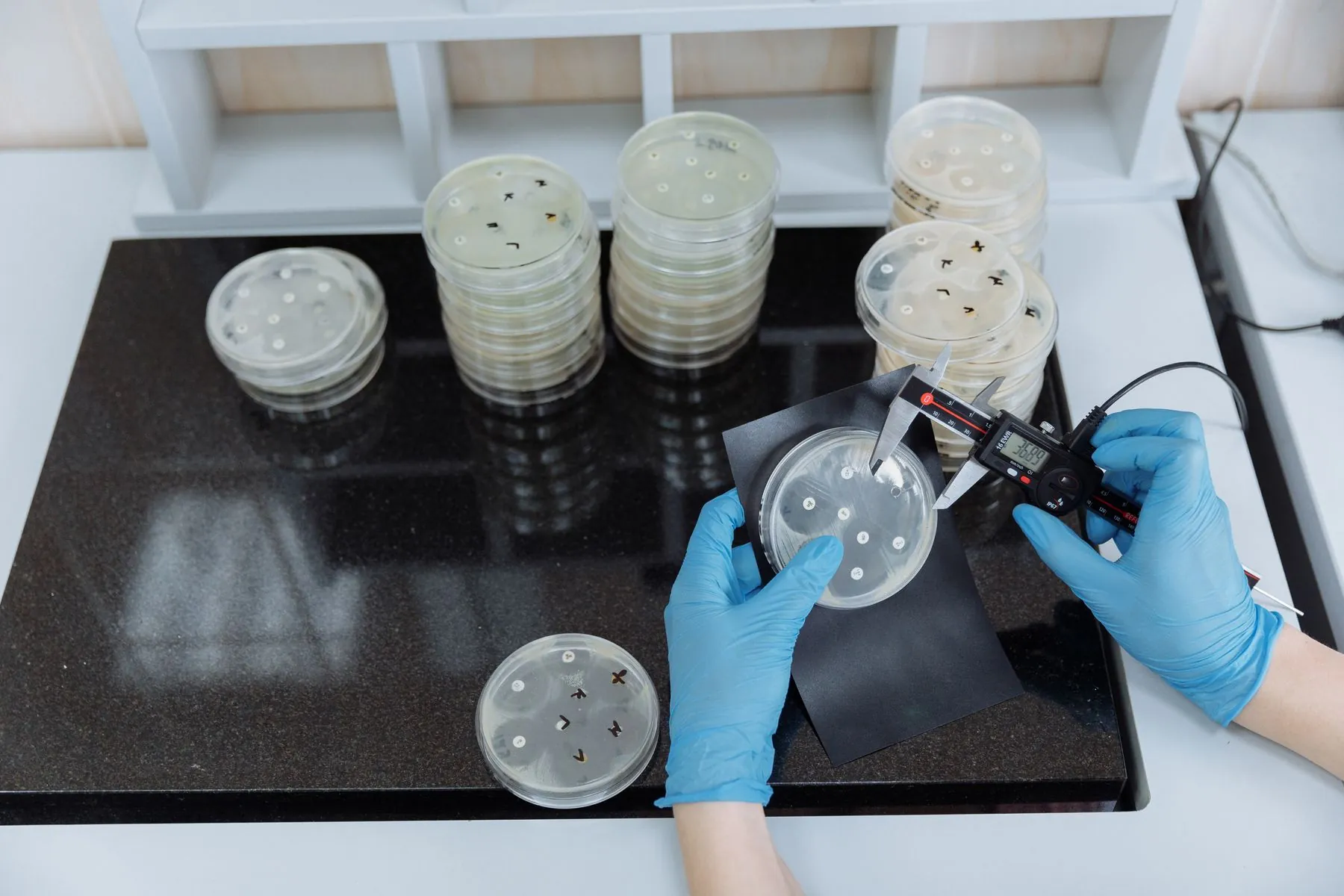 Laboratory assessment of microbiological samples